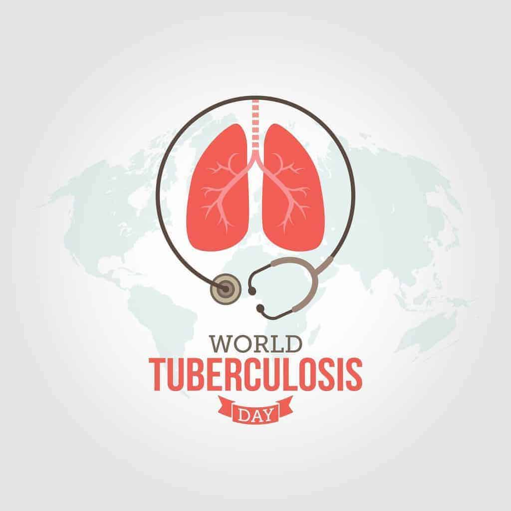 tuberculosis TB Medical Supply Company