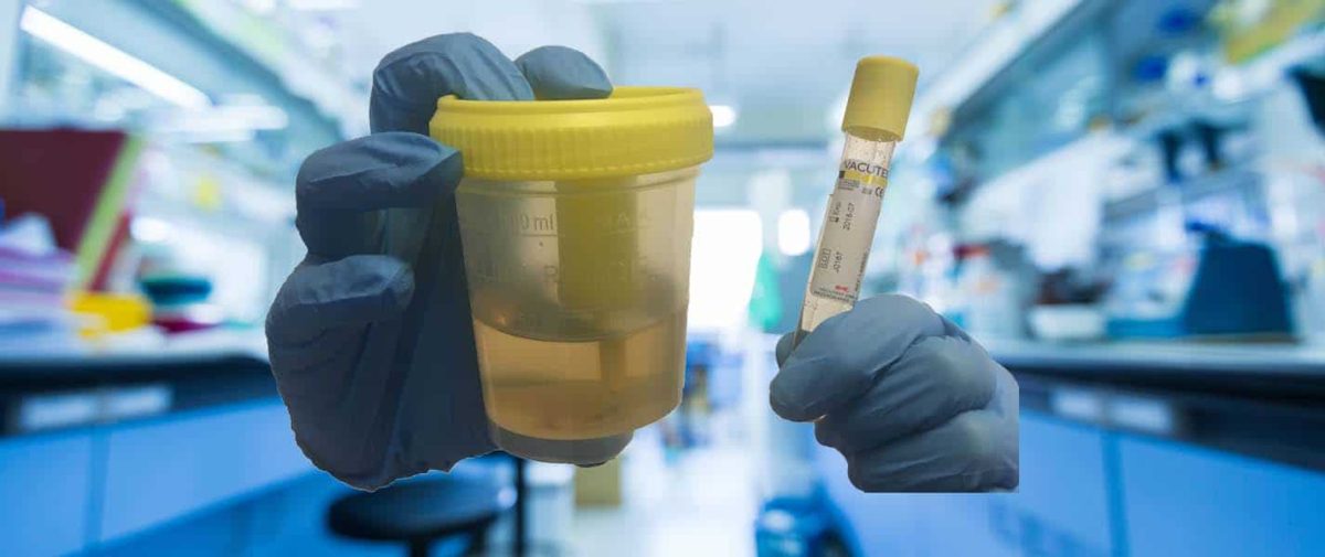 Vacutest Kima Urine Collection Kits Banner