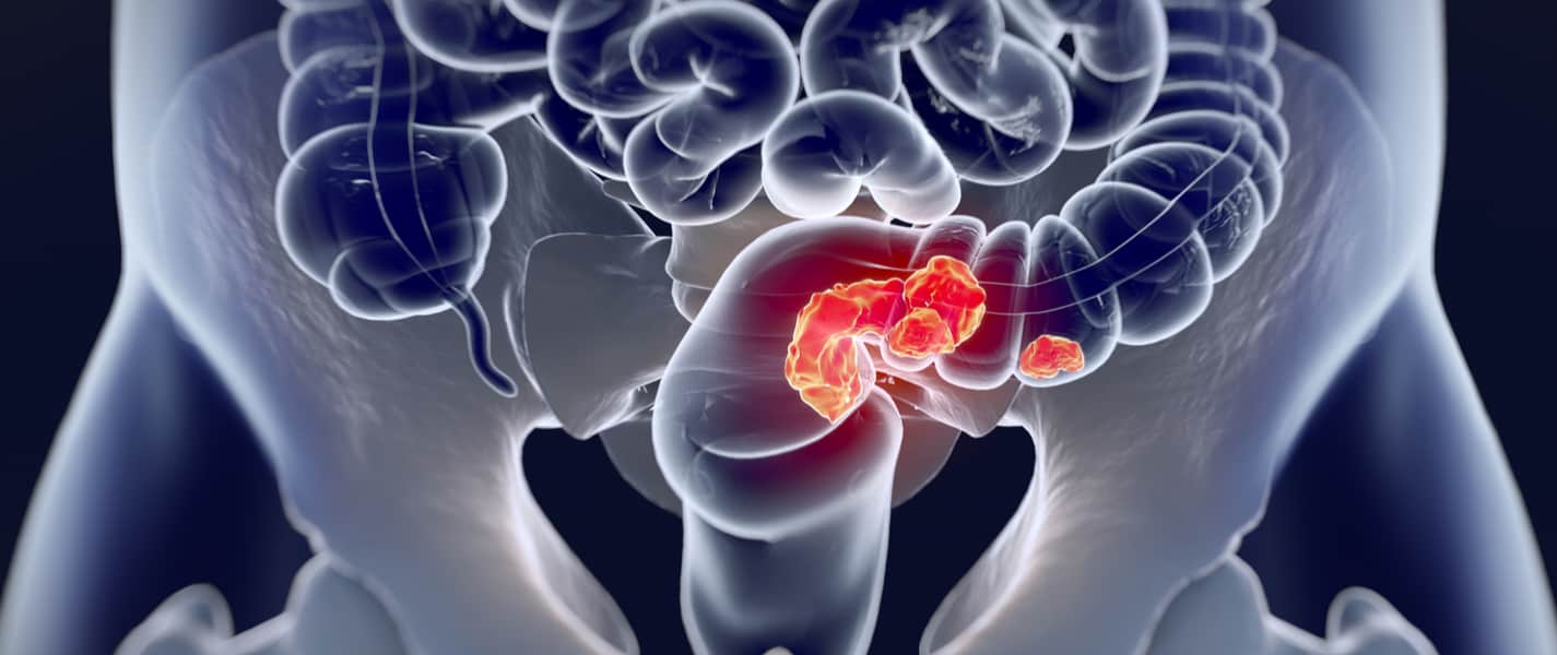 Easy PGX ready FL DNA Blog Image