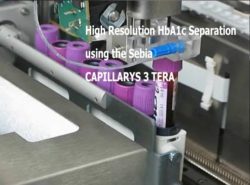 Sebia Capillary Testing Icon High Resolution HbA1c Separation using the Sebia CAPILLARYS 3 TERA ...