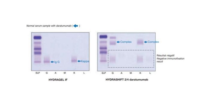 Sebia Tests SEBIA HYDRASHIFT 2/4 daratumumab test kit | Medical Supply Company LTD