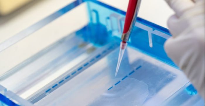 Sebia Tests SEBIA HYDRASHIFT 2/4 daratumumab test kit | Medical Supply Company LTD