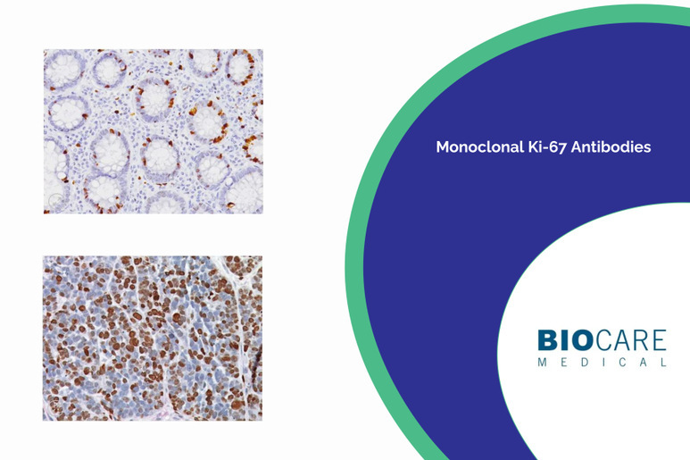 Monoclonal Ki-67 Antibodies | Medical Supply Company